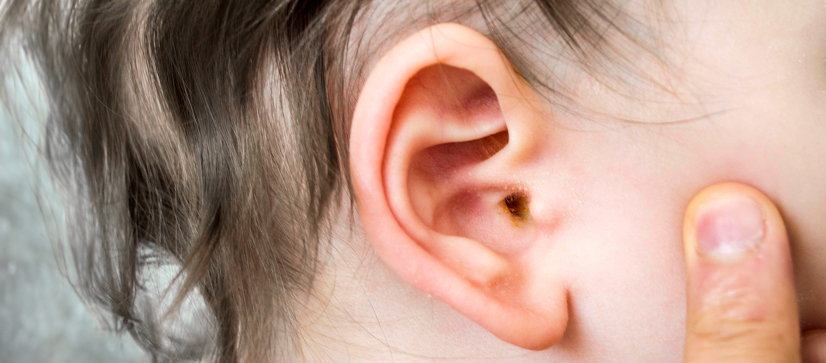 Earwax Explained Origin, Types & Care Tips