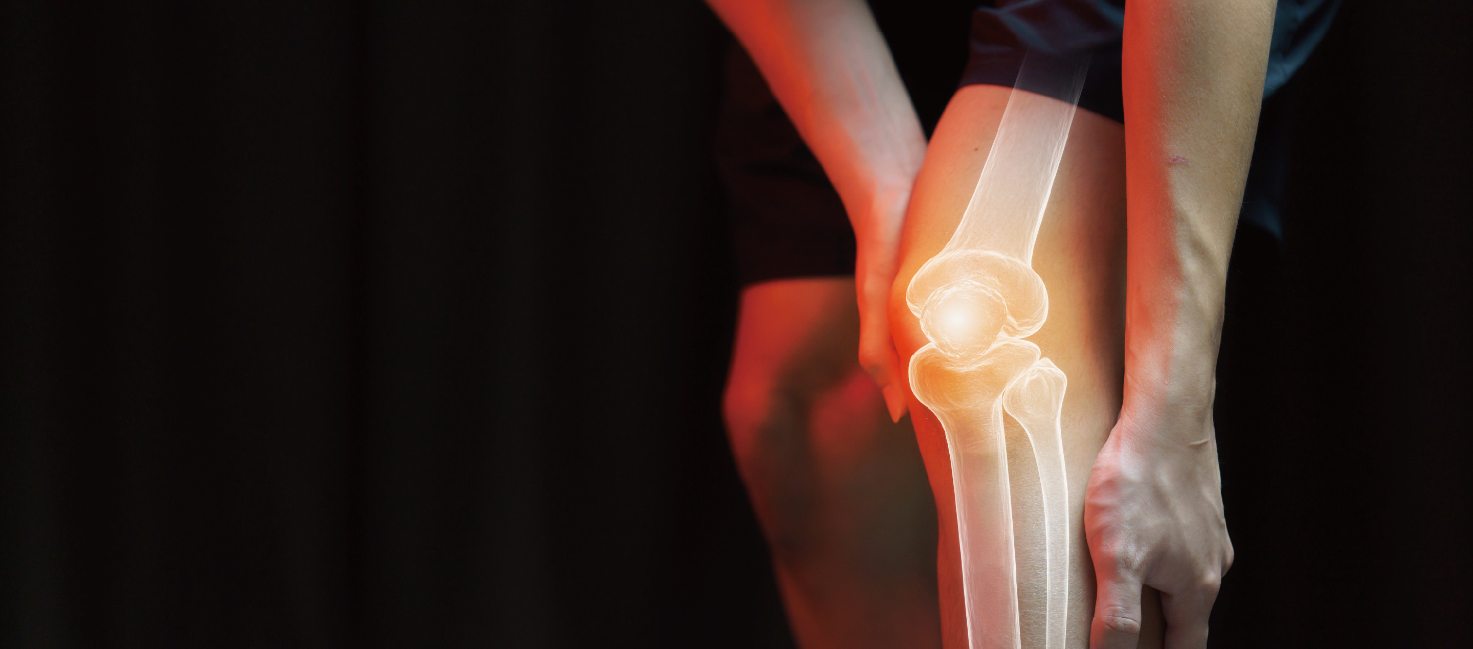 什么是半月板与十字韧带?解析撕裂、损伤症状与治疗