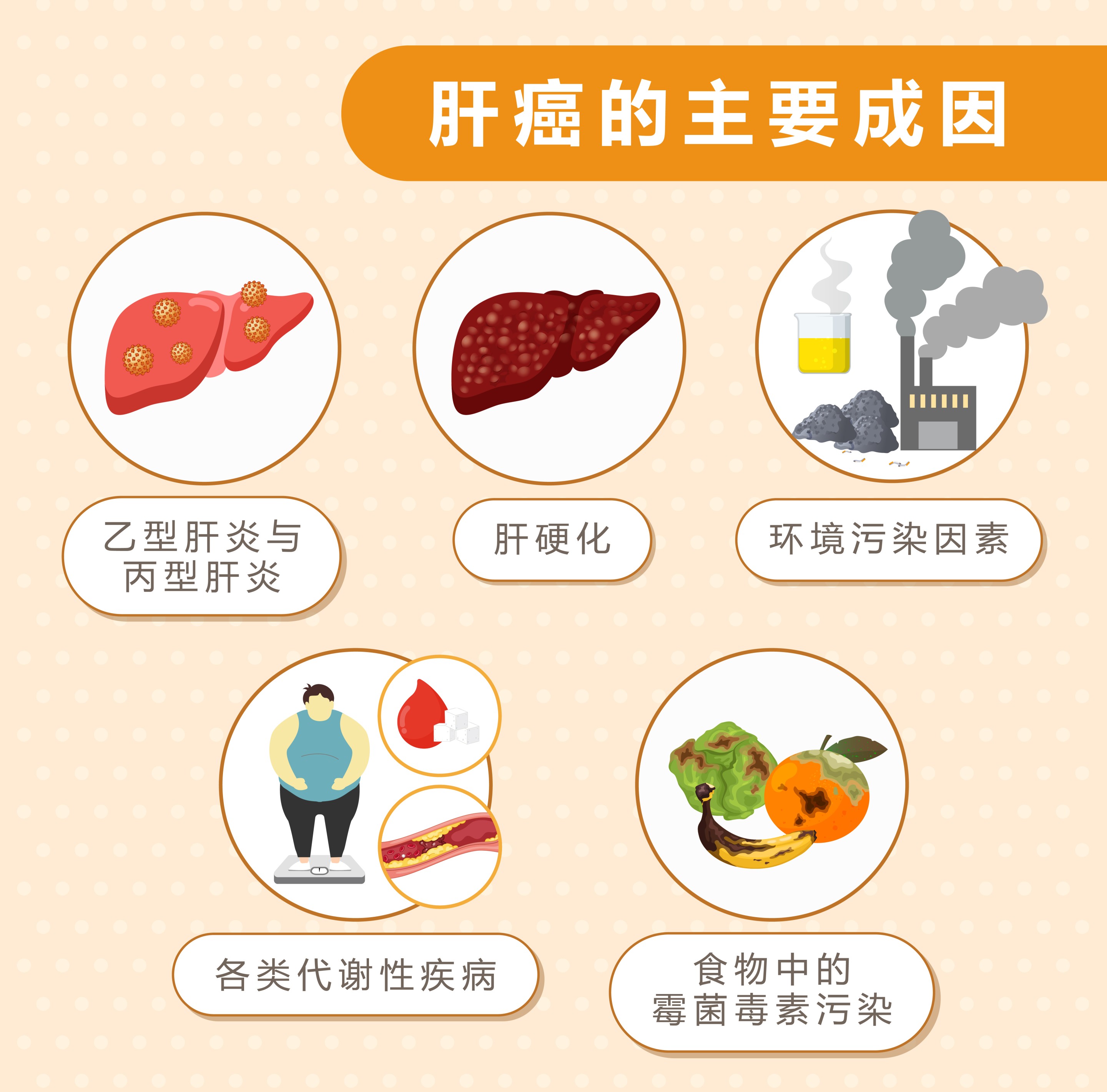 肝癌的主要成因 sc