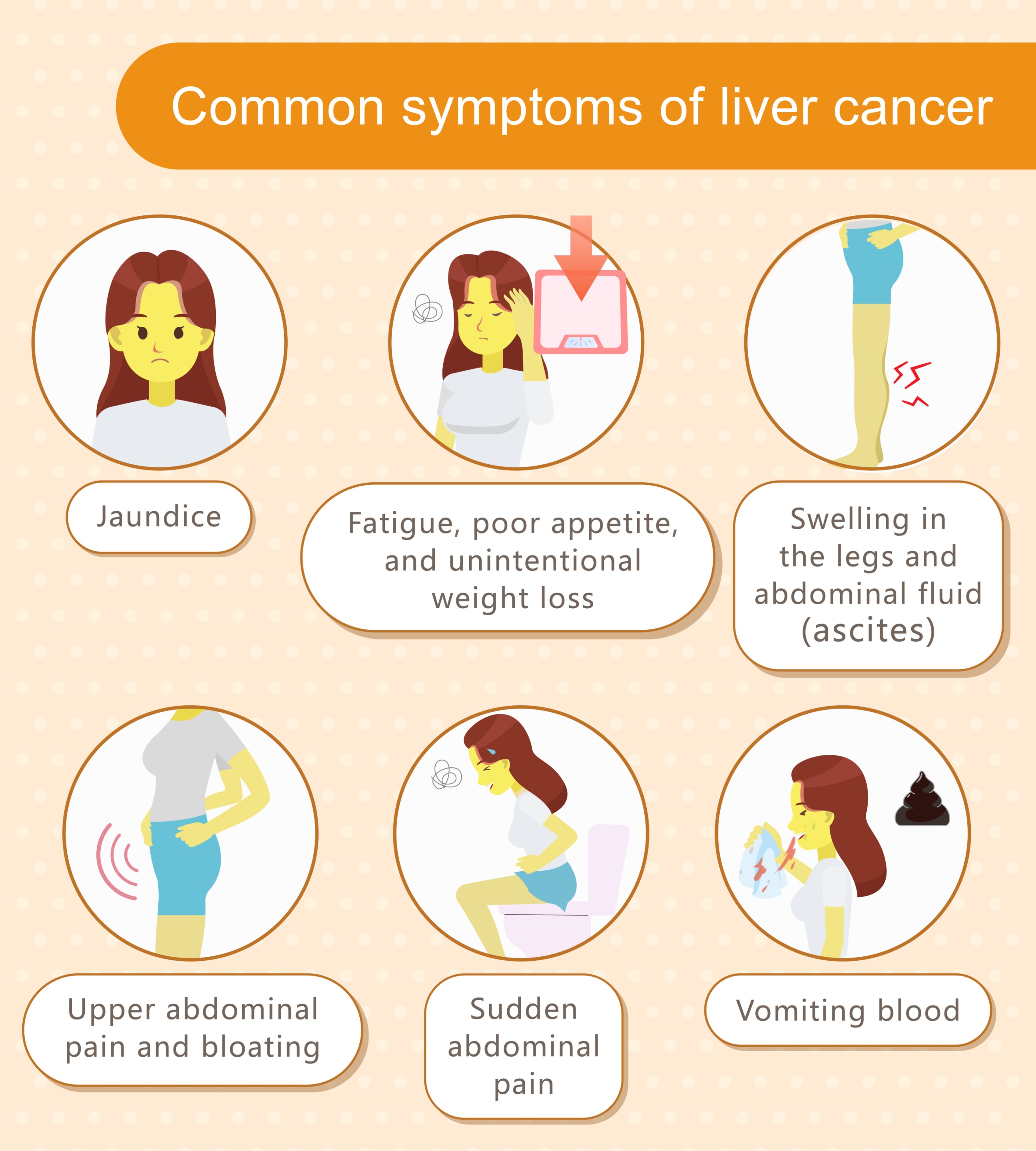 Common symptoms of liver cancer