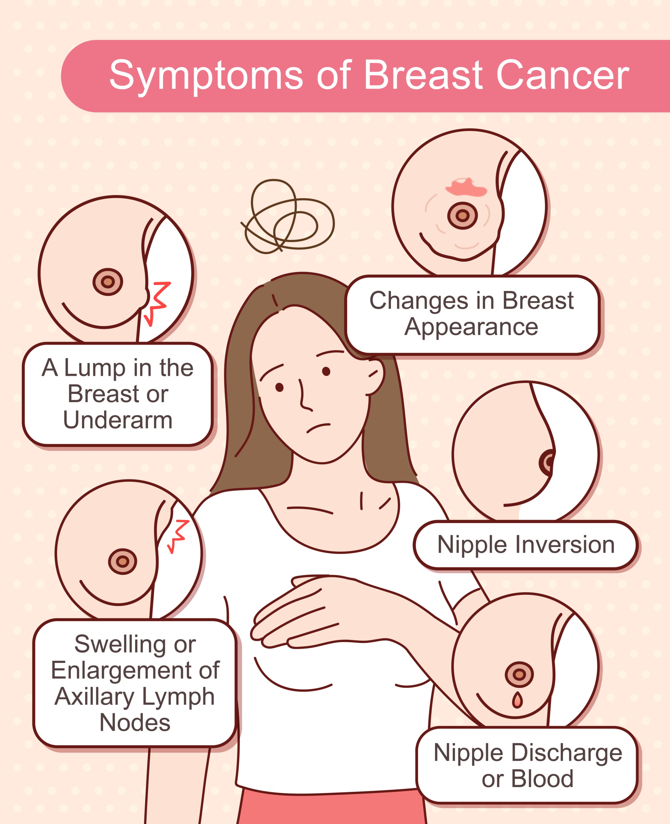 Symptoms of Breast Cancer