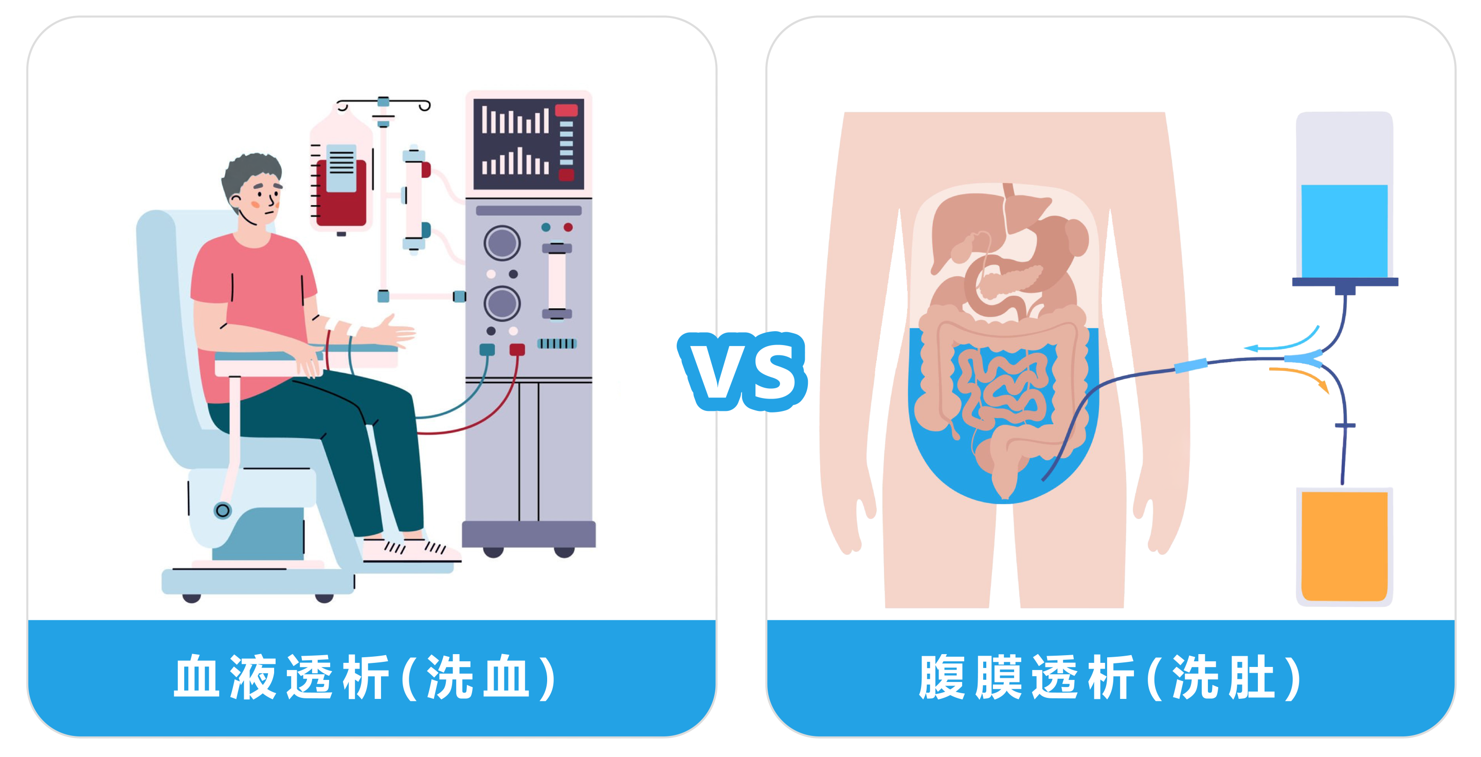 血液透析 洗血 vs 腹膜透析 洗肚